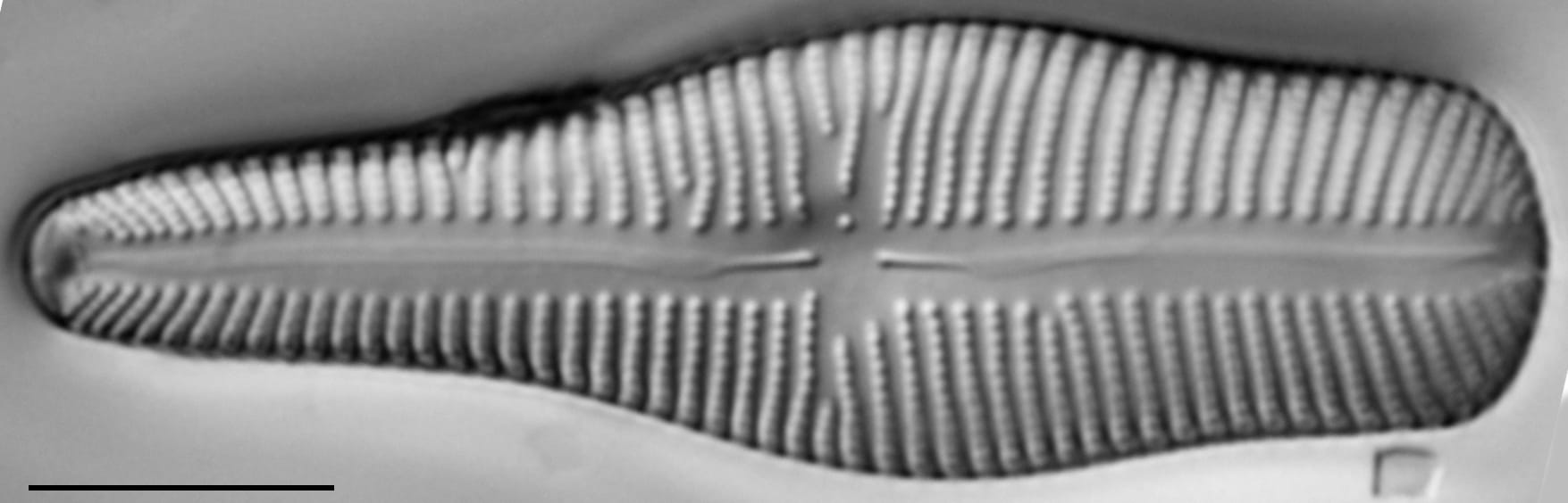 Gomp Turg 15670B 12072015 Cl