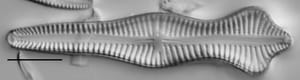 Gomphonema Acuminatum 001