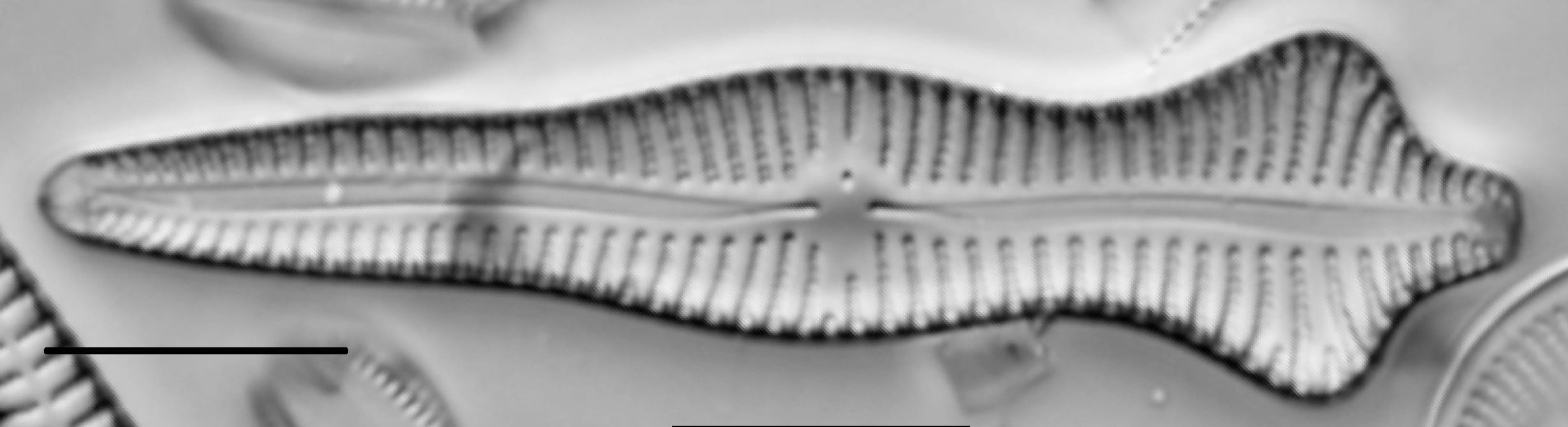 Gomphonema Acuminatum 003