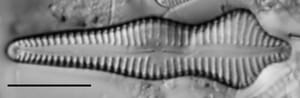 Gomphonema Acuminatum 004
