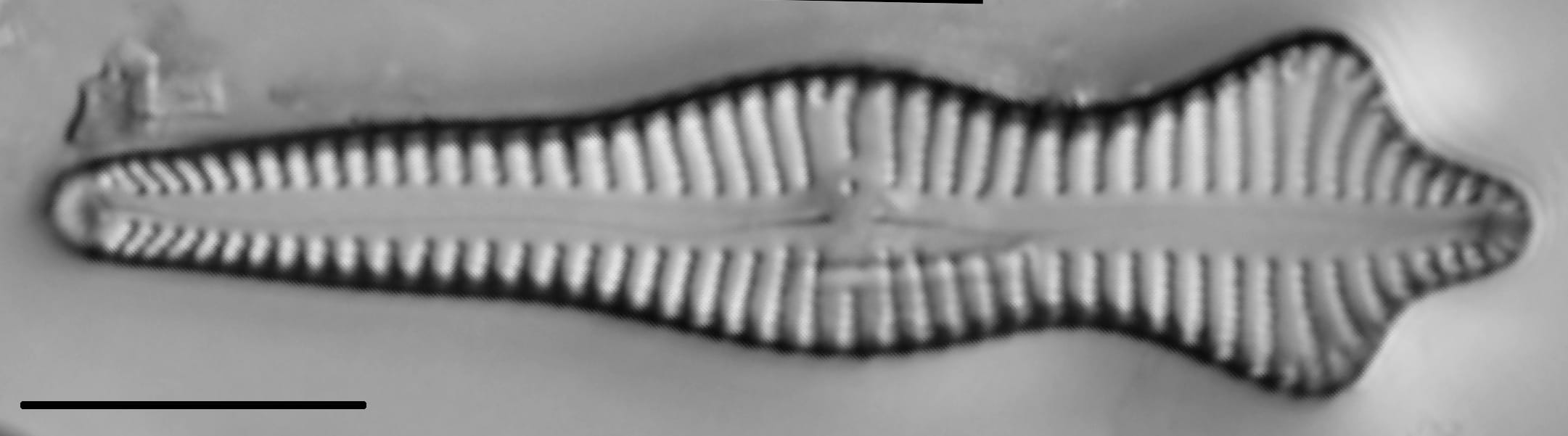 Gomphonema Acuminatum 005