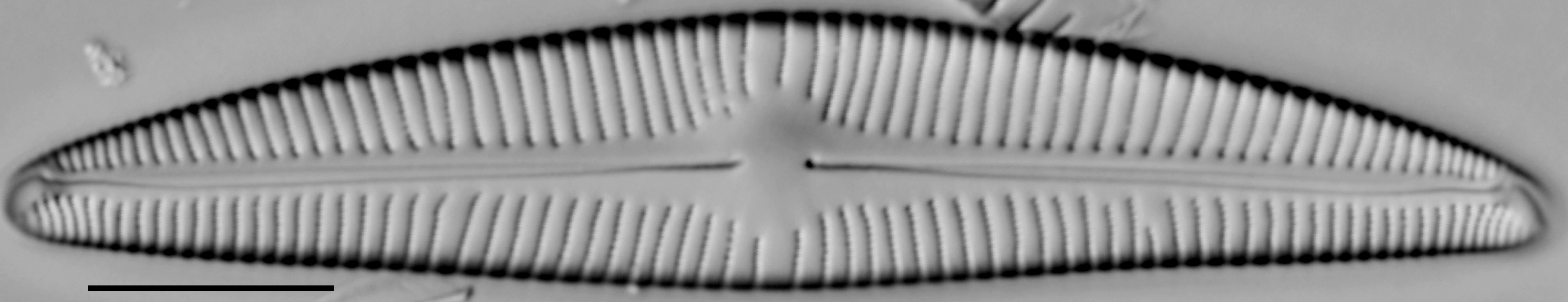 Encyonema hebridicum LM1