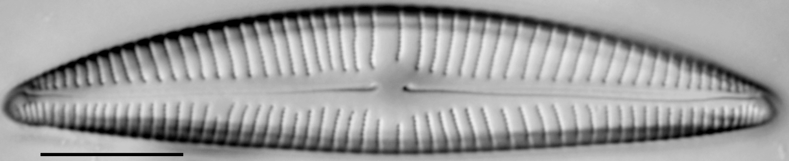 Encyonema hebridicum LM2