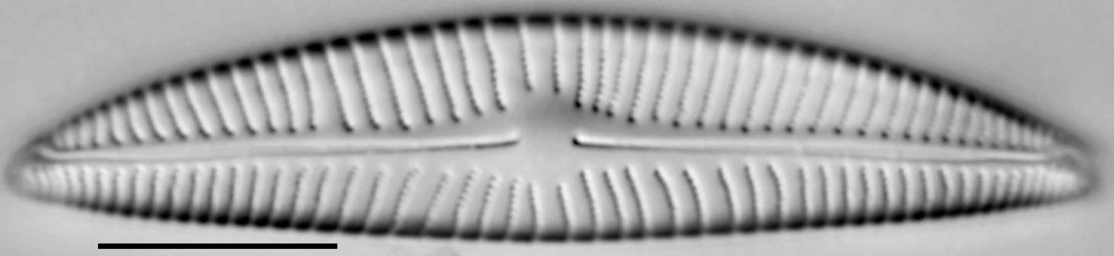 Encyonema hebridicum LM3