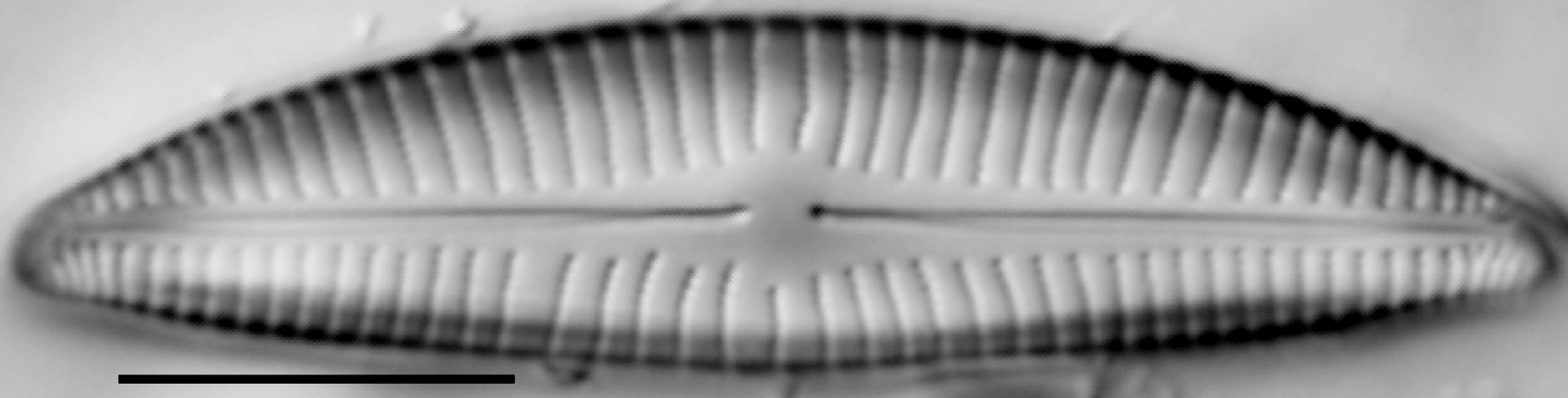 Encyonema hebridicum LM4