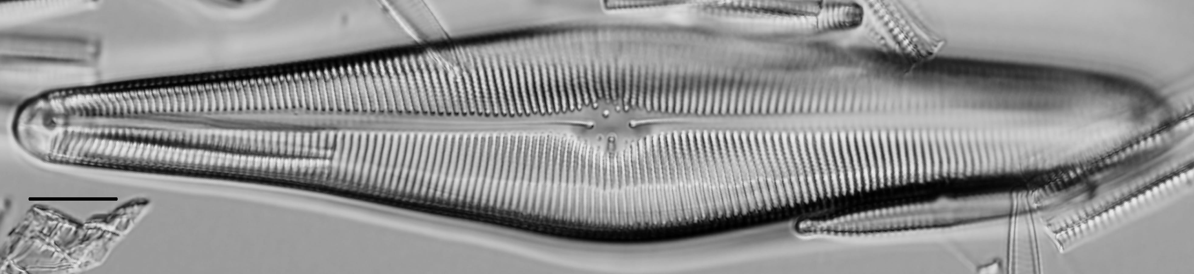 Gomphoneis herculeana LM1