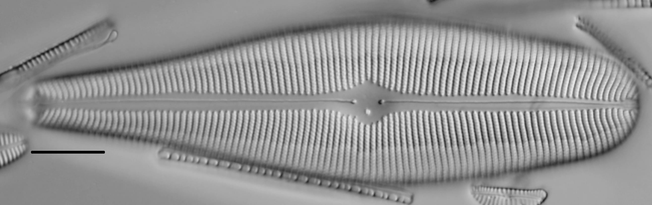 Gomphoneis herculeana LM2