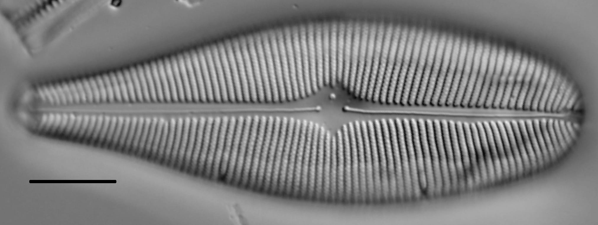 Gomphoneis herculeana LM5