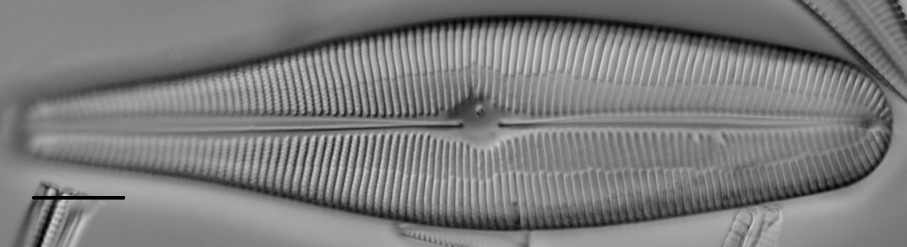 Gomphoneis herculeana LM6