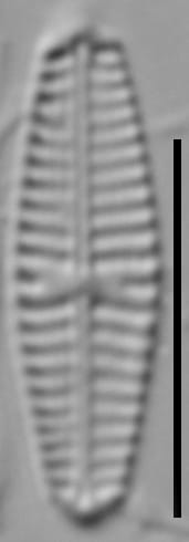 Hip Pseud 15656A 09162015 09 Cl