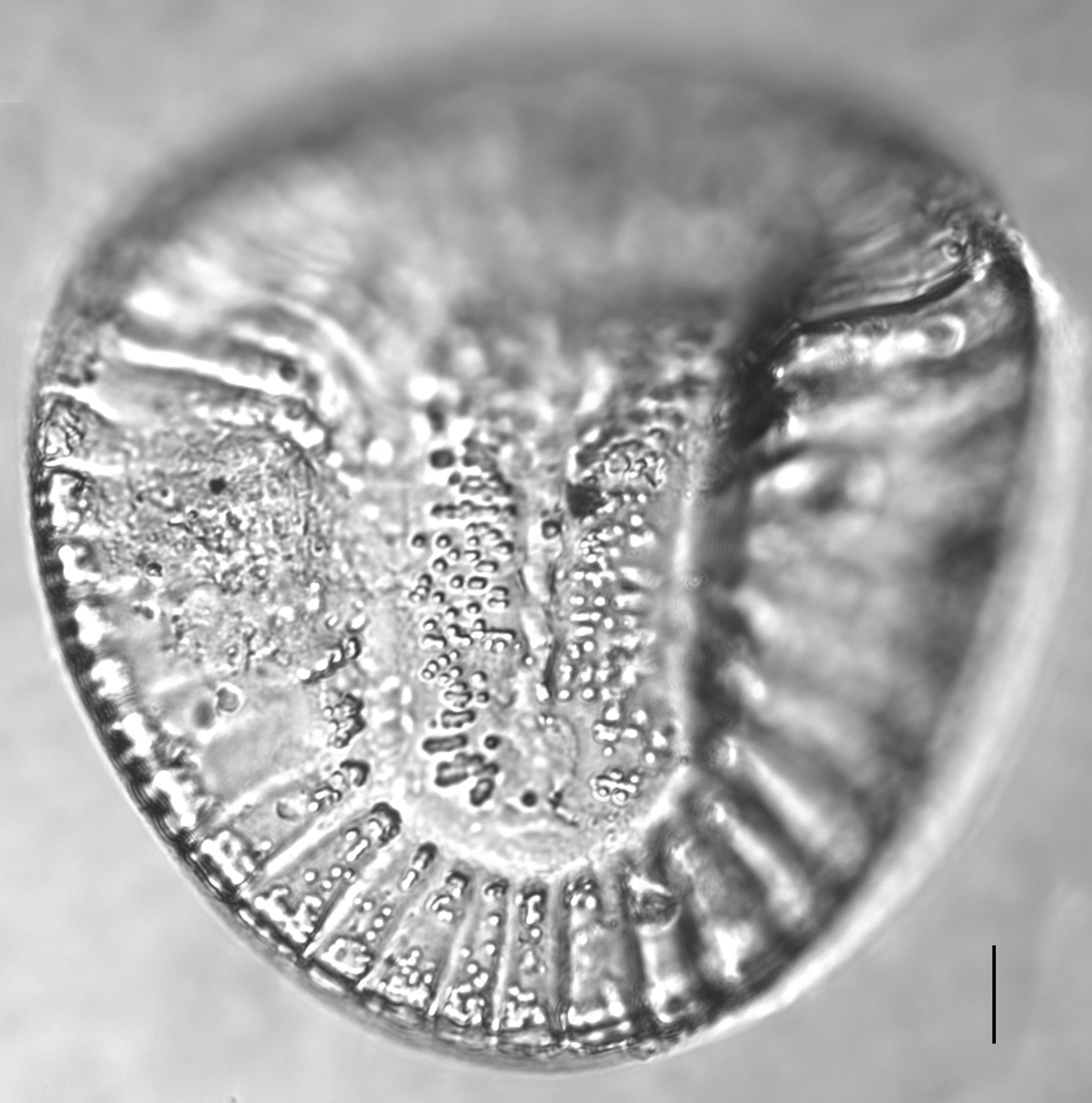 Campylodiscus clypeus_LM3