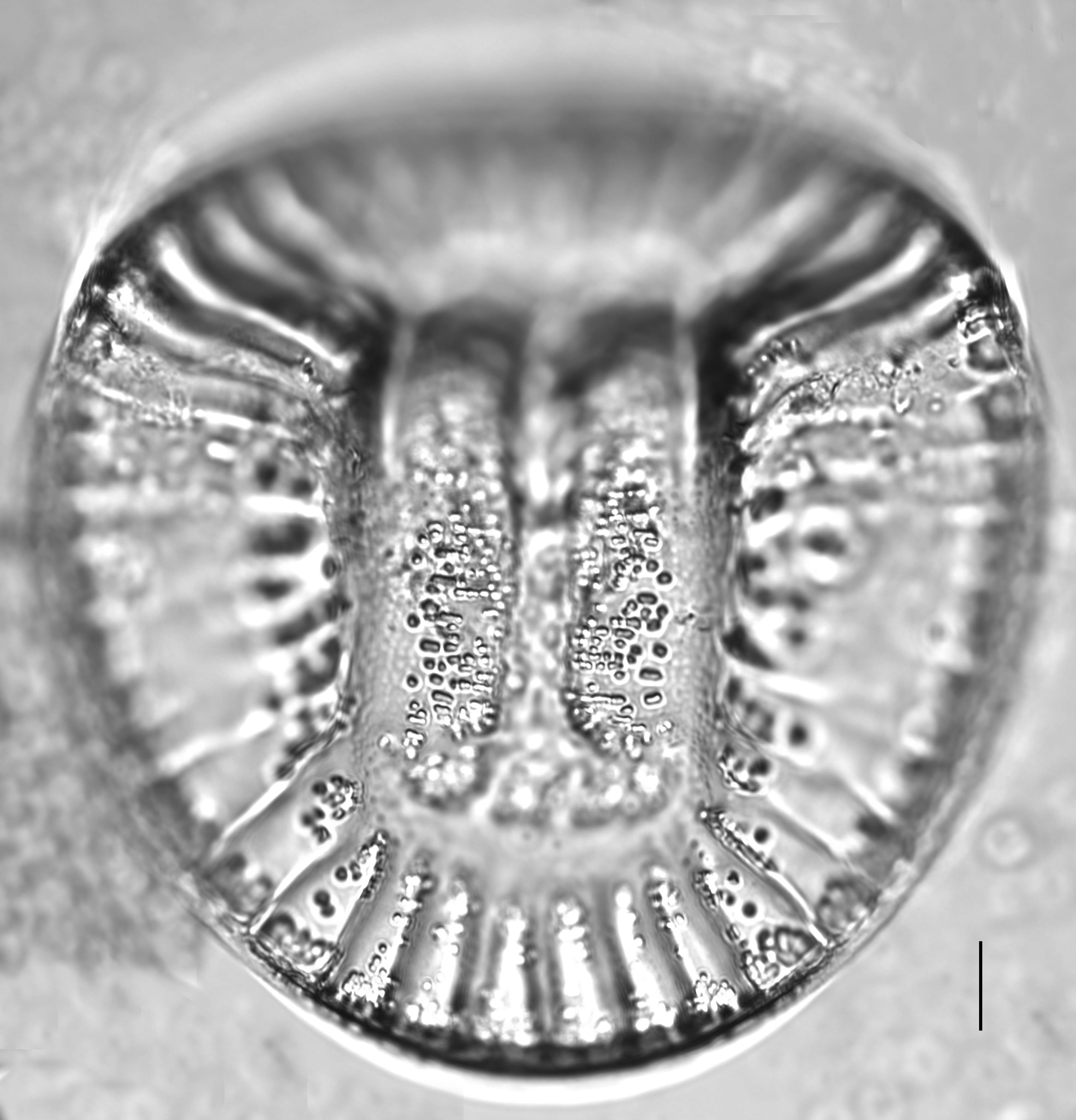 Campylodiscus clypeus_LM5
