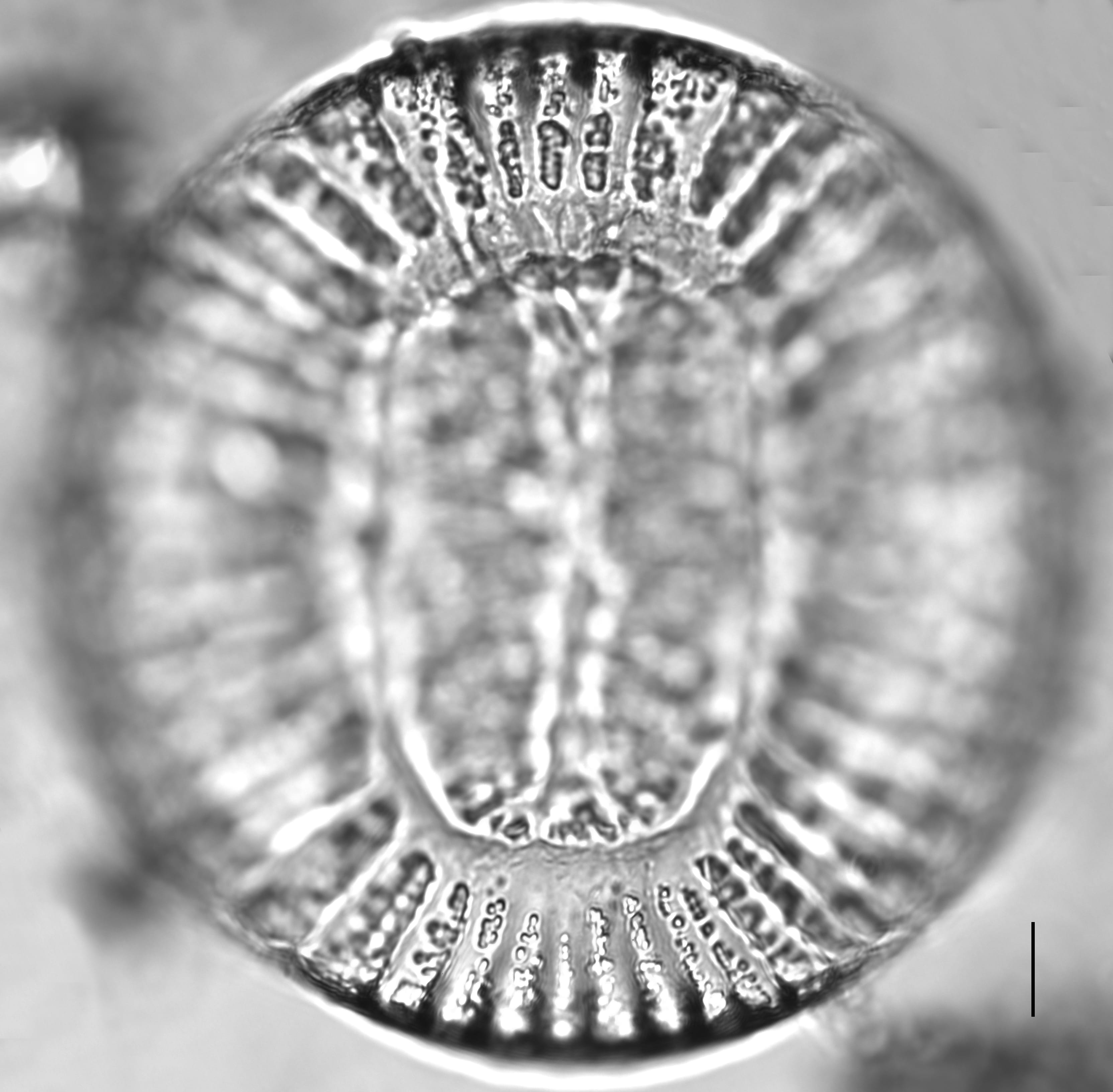 Campylodiscus clypeus_LM4