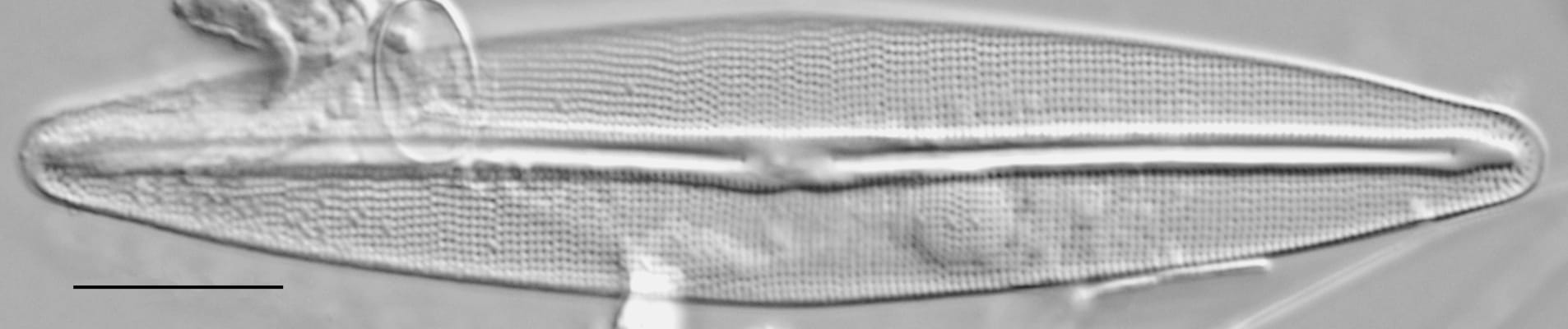 Frustulia incluta LM1