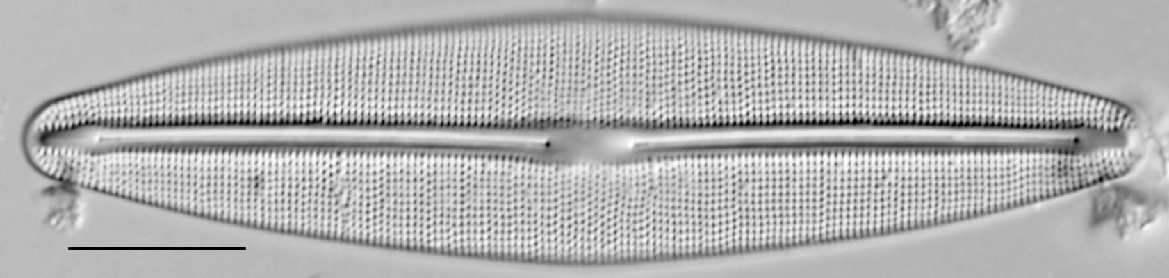 Frustulia incluta LM2