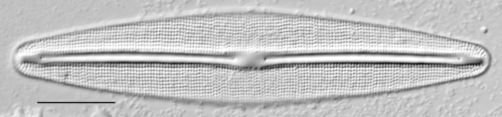 Frustulia incluta LM3