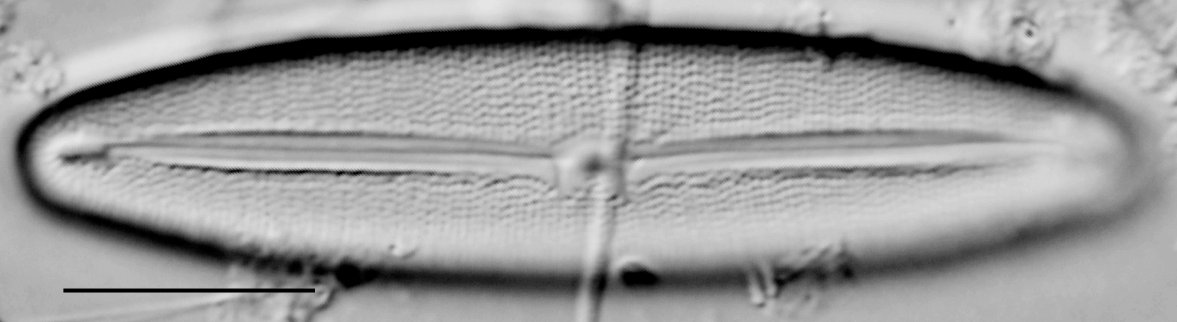 Frustulia latita LM1