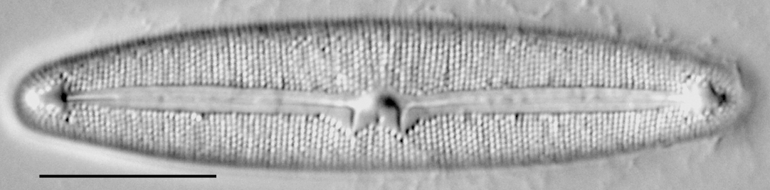 Frustulia latita LM2