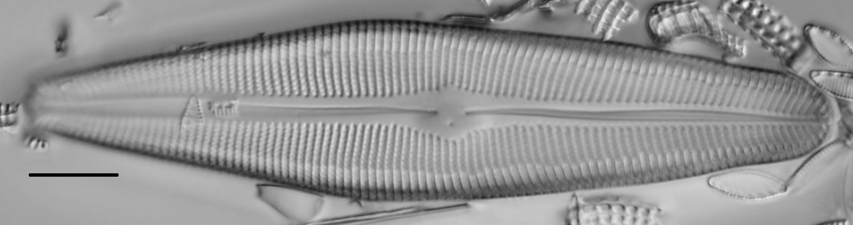 Gomphoneis herculeana var. lowei LM1