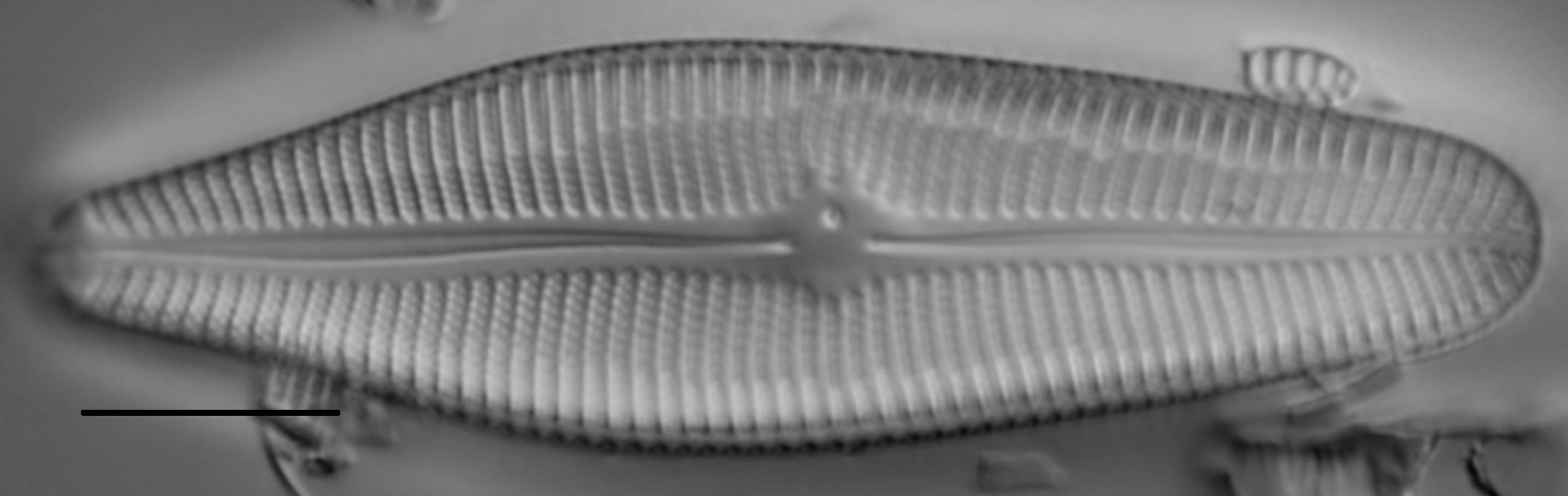 Gomphoneis herculeana var. lowei LM2