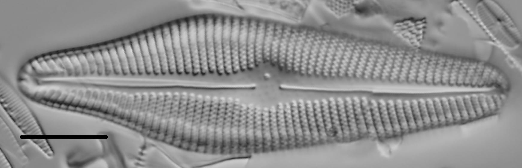 Gomphoneis herculeana var. lowei LM3