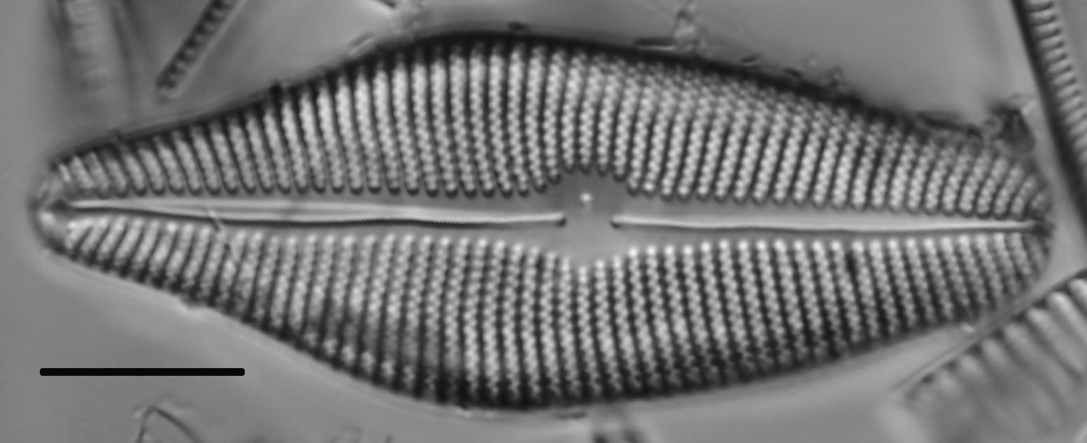 Gomphoneis herculeana var. lowei LM5