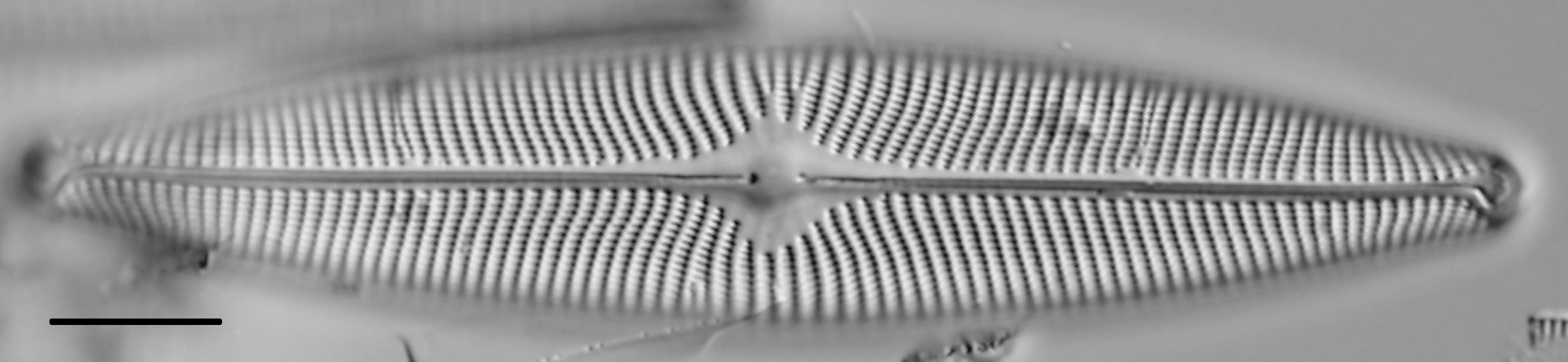 Navicula vulpina LM5