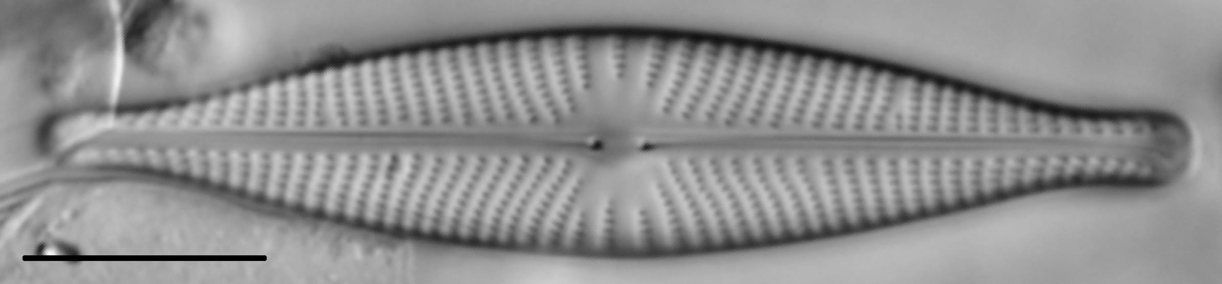 Navicula rhynchocephala LM5