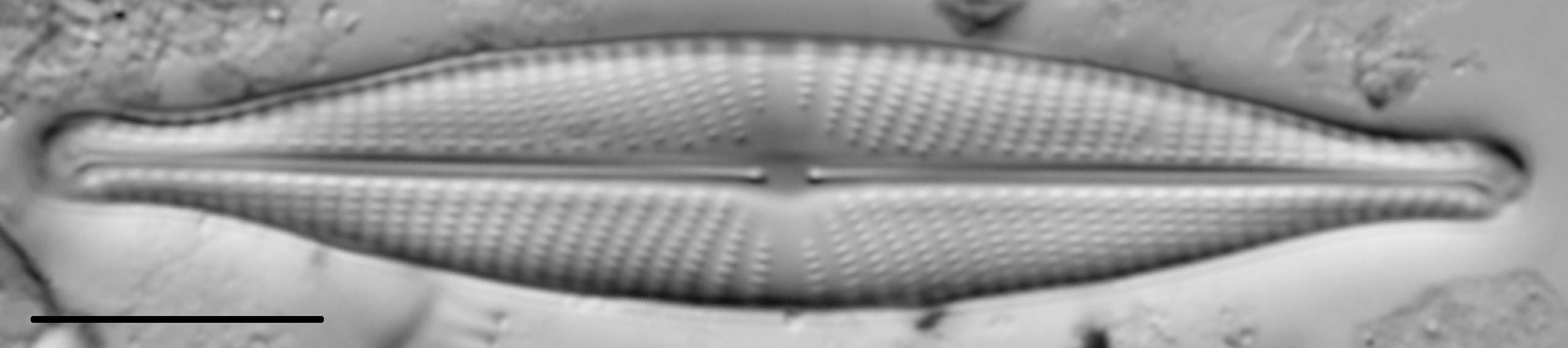 Navicula rhynchocephala LM2