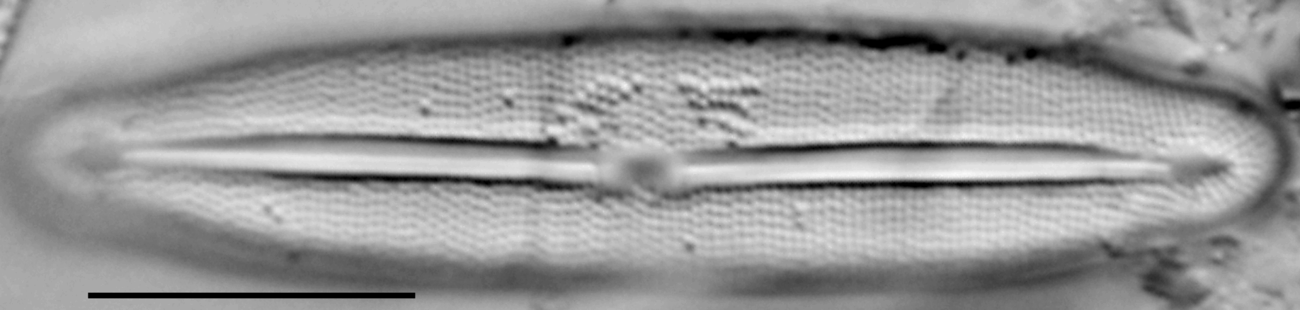 Frustulia neomundana LM1