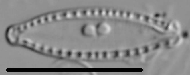 Nitzschia microcephala LM5