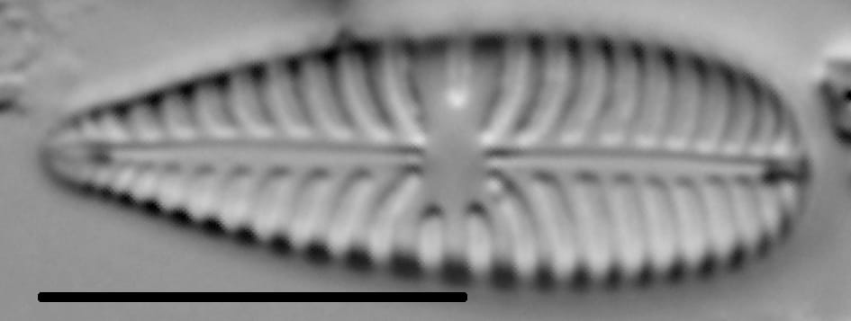 Gomphoneis olivaceum LM7