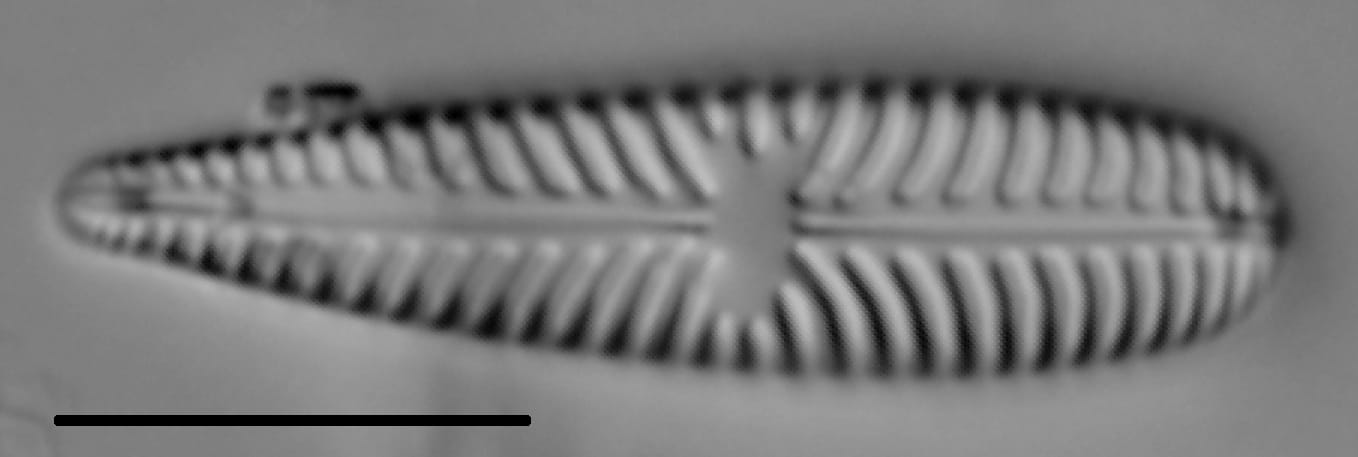 Gomphoneis olivaceum LM6