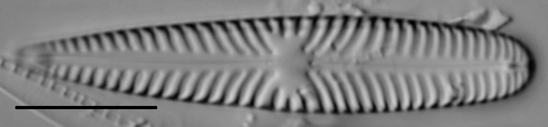 Gomphoneis olivaceum LM5