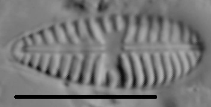 Gomphoneis olivaceum LM4