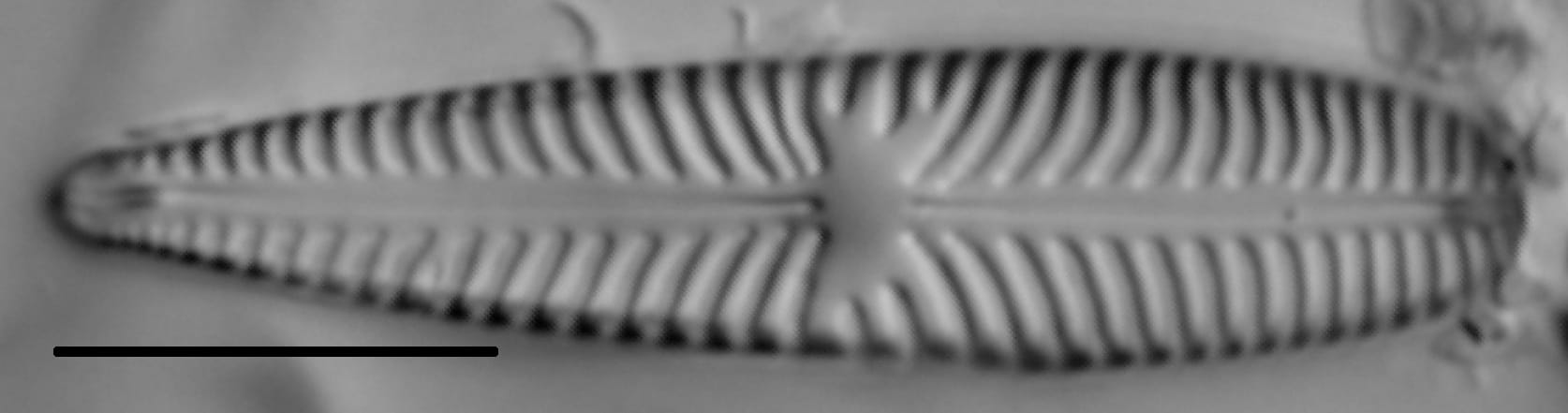 Gomphoneis olivaceum LM3