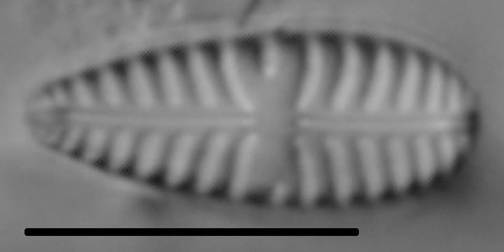 Gomphoneis olivaceum LM2