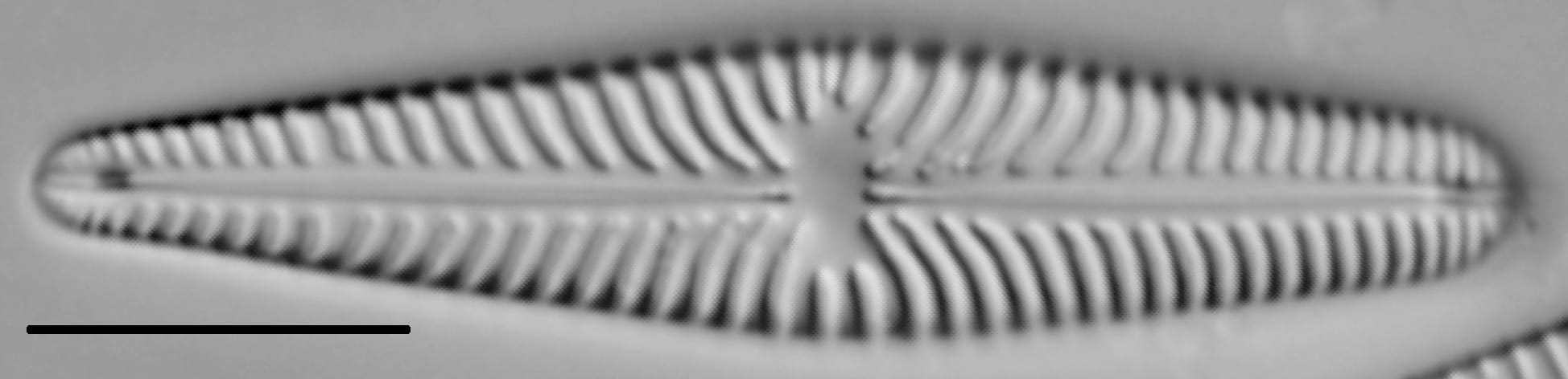 Gomphoneis olivaceum LM1