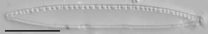 Nitzschia palea LM6