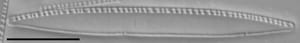 Nitzschia palea LM5
