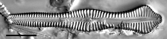 Gomphonema pusillum LM7