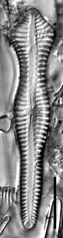Gomphonema pusillum LM6