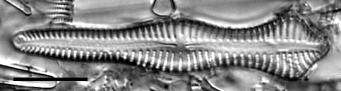 Gomphonema pusillum LM6