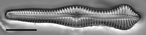 Gomphonema pusillum LM5