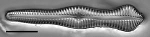 Gomphonema pusillum LM5