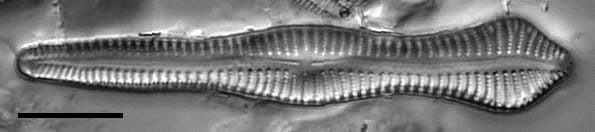Gomphonema pusillum LM4