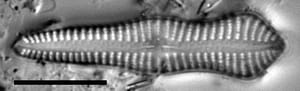 Gomphonema pusillum LM2
