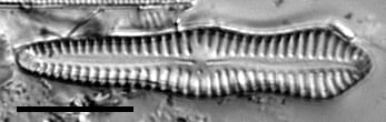 Gomphonema pusillum LM1