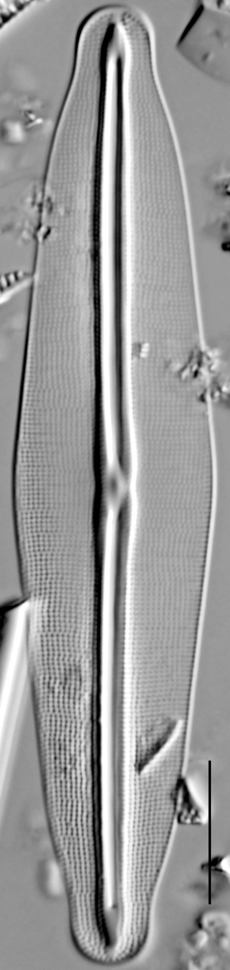 Frustulia quadrisinuata LM2