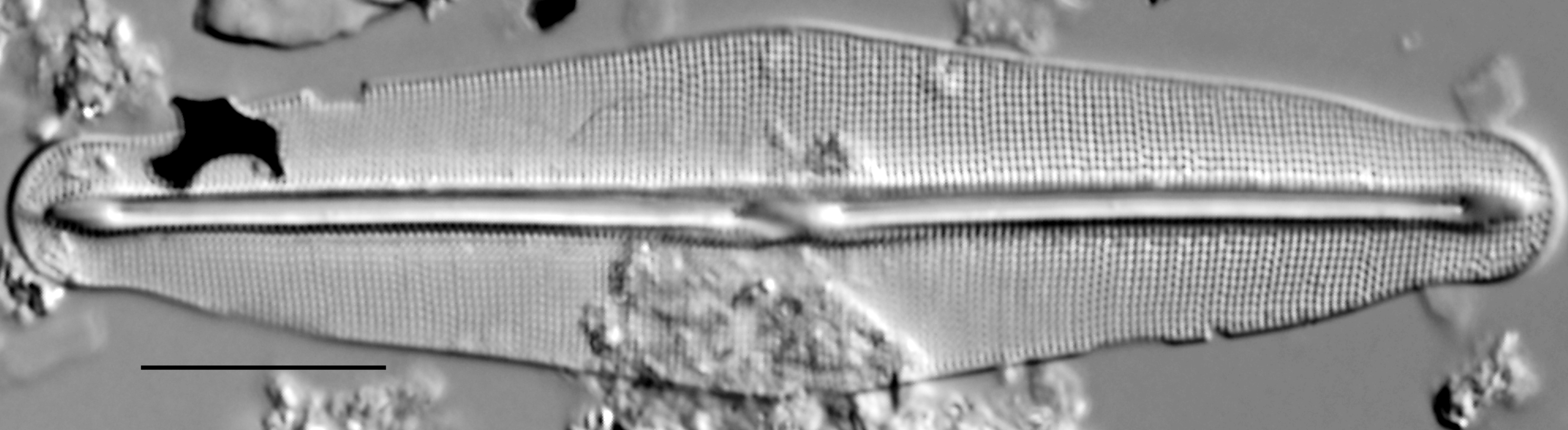 Frustulia quadrisinuata LM5